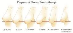 breast nipple position