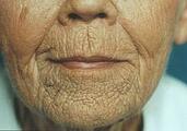 old lips