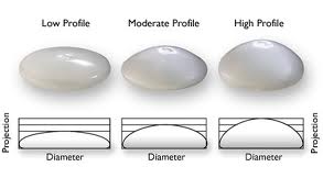 implant profiles