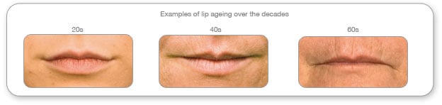 lips ageing