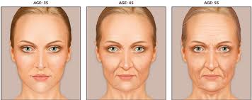 facial aging